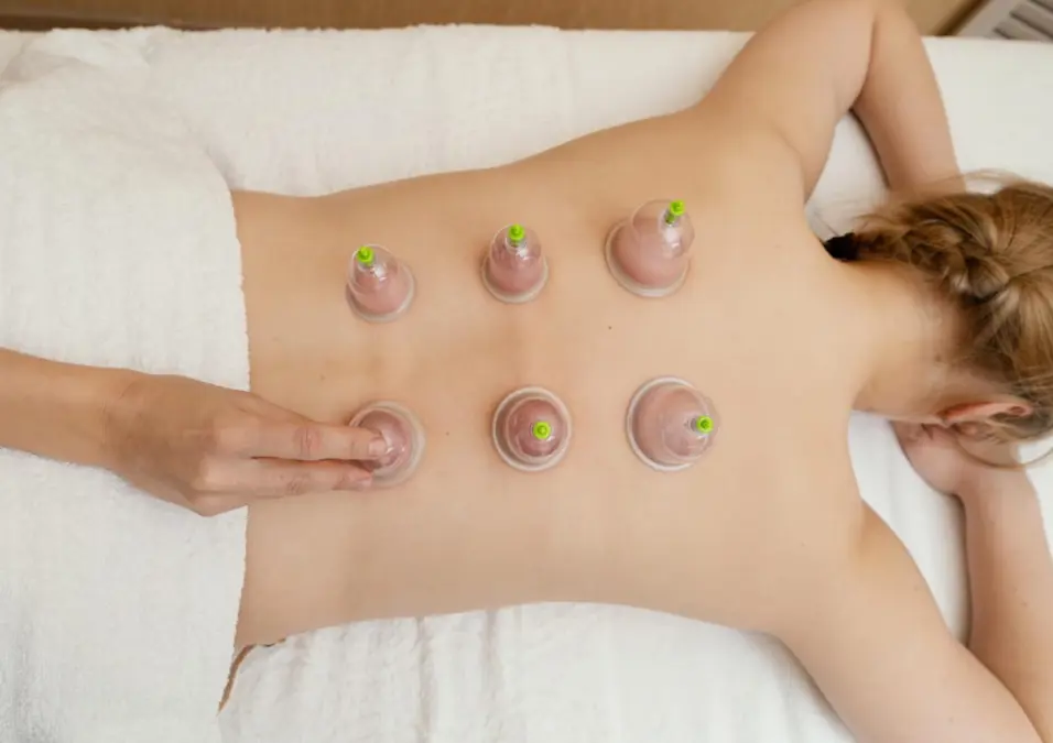 شخص يتلقى جلسة حجامة على ظهرها، يوحي بفوائد الحجامة للنساء، أنواعها، أضرارها، وأهم النصائح.