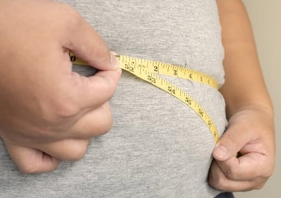 Obesity
